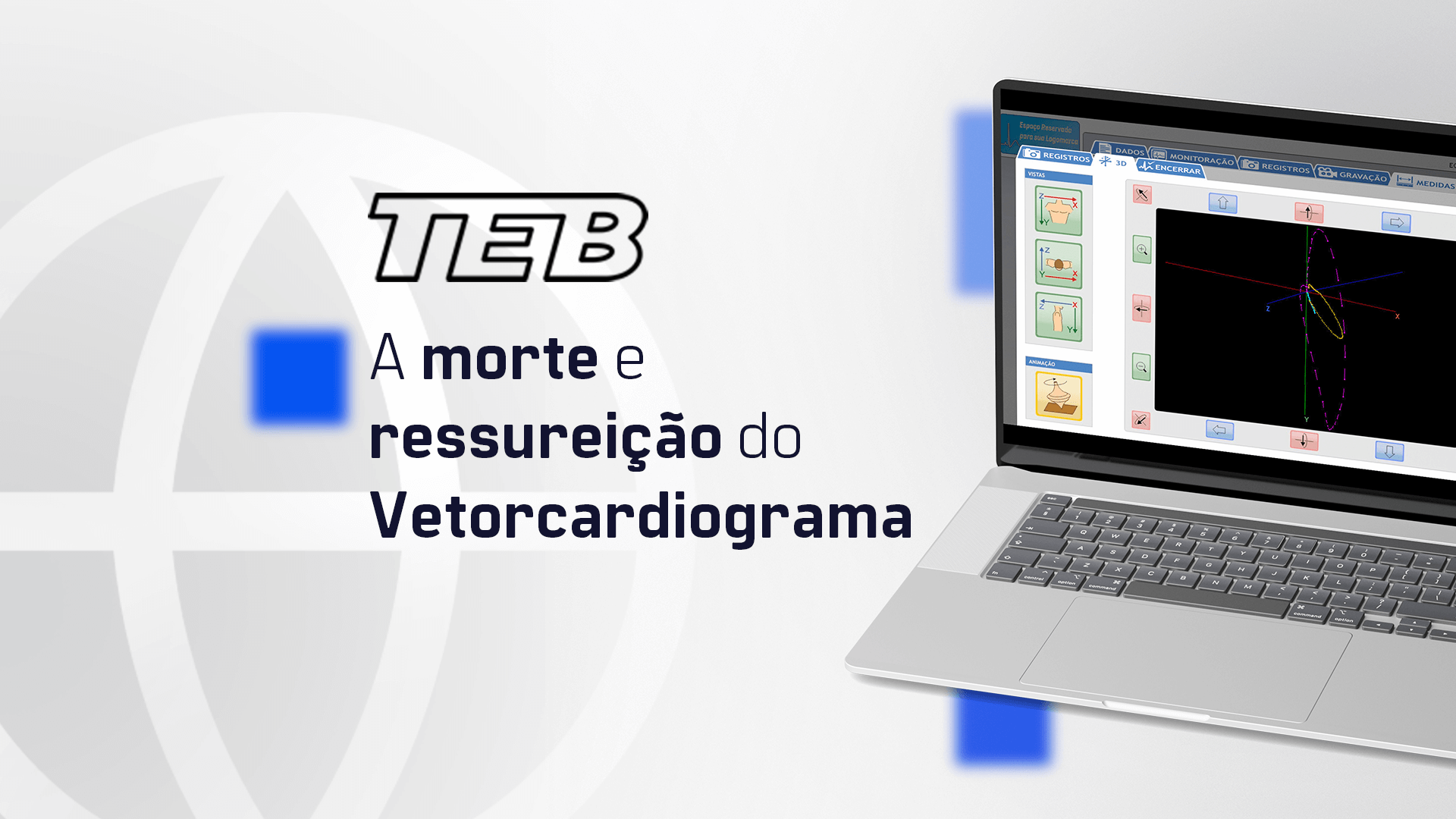 Leia mais sobre o artigo Morte e Ressurreição do Vetorcardiograma