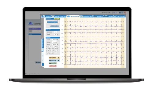 ELETROCARDIÓGRAFO TEB ECGPC - 2